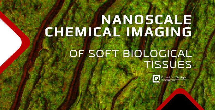 Nanoscale Chemical Imaging of Soft Biological Tissues
